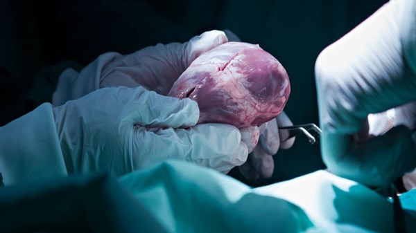 Organ Nakillerinden Sonra Bazen Ürkütücü Kişilik Değişimleri Yaşanabiliyor