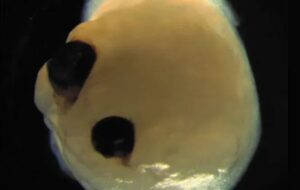 Bilim İnsanları Beyin Dokusunu 18 Ay Boyunca Dondurdu ve Sonra Çözdü