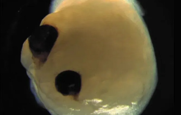 Bilim İnsanları Beyin Dokusunu 18 Ay Boyunca Dondurdu ve Sonra Çözdü