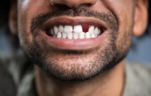 Medicine For Regrowing Teeth To Be Tested On Humans For The First Time
