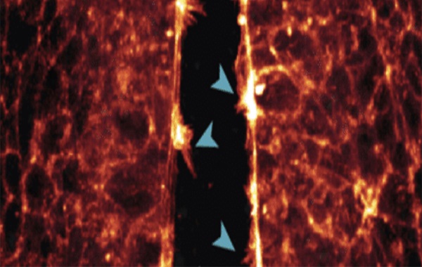 Incredible New Tech Lets Scientists Watch Fetuses Develop in Real Time