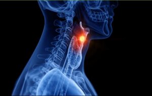 Kanser Hastasına Sesini