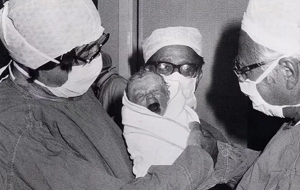 Dünyanın İlk Tüp Bebeği: İngiliz Kadın Louise Joy Brown'ın Hayatı