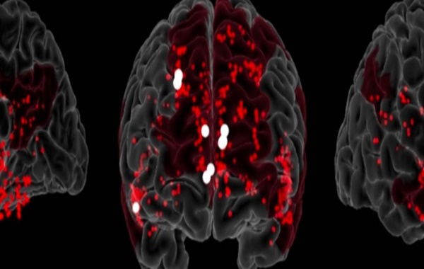 Yaratıcılığın Beyindeki Sinirsel