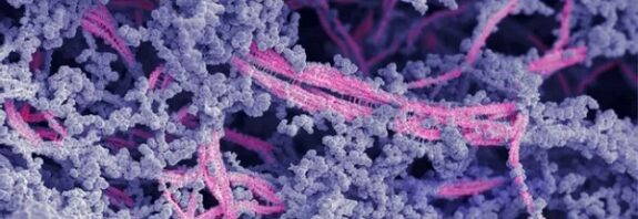 Injectable Goo Could Fix Joints Without Surgery