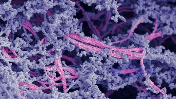 Injectable Goo Could Fix Joints Without Surgery