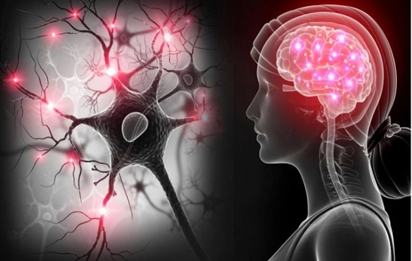 Alzheimera Dair