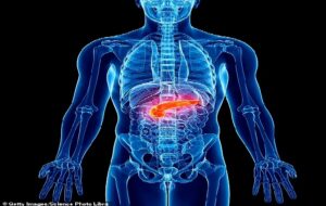 Breakthrough as woman's type 1 diabetes is CURED in world-first using stem cells