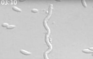 Bu Korsan Bakterilerin “Kancaları” ve “Silahları” Var