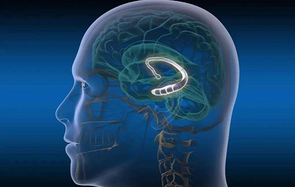 Sinirbilimciler Hipokampustaki Nöronlara İlaç Göndermeyi Başardı