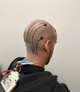 Mind-Reading Tattoos The Future of Brainwave Monitoring