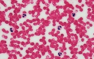 Yeni Tedavi Kanser Hücrelerini Tekrar Normal Hücrelere Dönüştürüyor