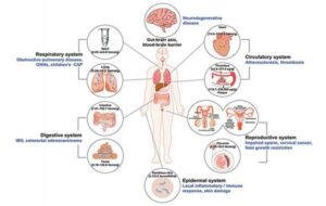 Microplastics Detected in Human Organ Tissues Linked to Lesions and Potential Health Risks
