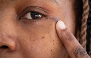 UK doctors remove brain tumor through eye socket for first time, use keyhole surgery