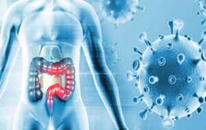 Yoğurt Bağırsak Kanseri Riskini Azaltıyor! Bu Nasıl Mümkün?