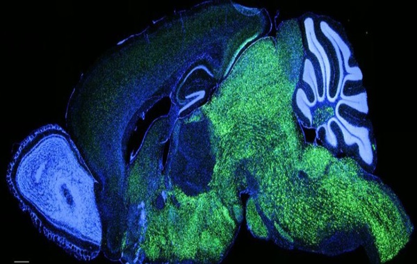 Mice With Human Language Gene Develop Altered Vocal Patterns
