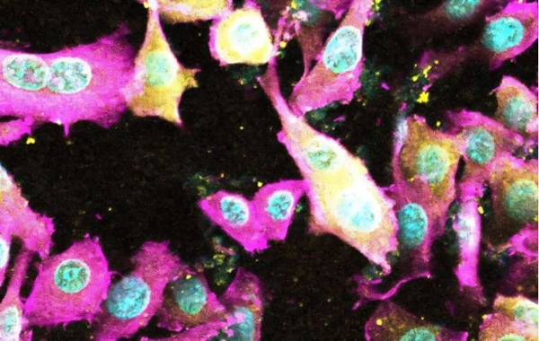 Scientists reveal new toxin that damages the gut