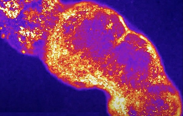 İnsan Ağrı Sinir Devresi İlk Kez Laboratuvarda Yeniden Oluşturuldu