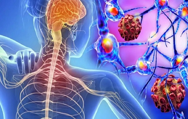 Bilim İnsanları Multipl Skleroz Gelişimiyle Bağlantılı Bakterileri Belirledi