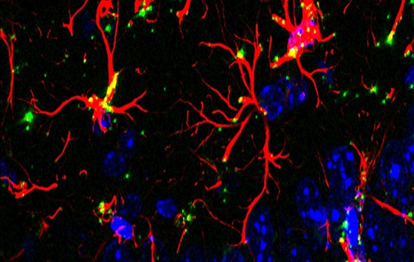 Scientists Discover Molecule That Blocks Aging And Dementia in Mice