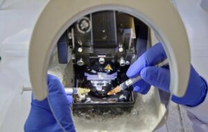 Researchers use live brain to expose Alzheimer’s effects before symptoms start