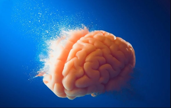 İnsan Beynindeki Yapısal