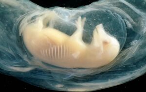 İnsan Kalbi Olan İlk Domuz Embriyoları Yetiştirildi