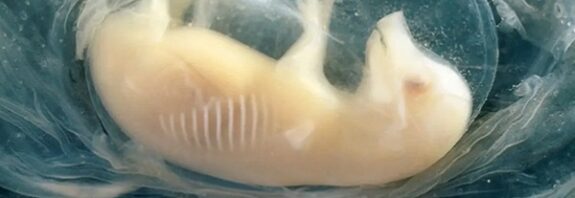 İnsan Kalbi Olan İlk Domuz Embriyoları Yetiştirildi