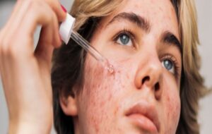 Does Retinol Reverse Signs of Aging? Here's The Science.