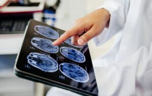 Metallic nanoflowers heal brain cells and extend lifespan in stunning new research