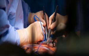 Surgeons Resuscitate 'Dead' Heart in Life-Saving Organ Transplant to Baby