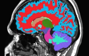 Harvard-Duke scientists decode brain’s aging clock using a single MRI scan 