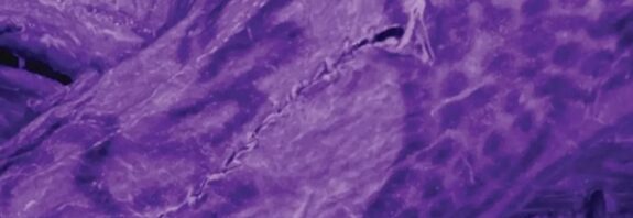 2.300 Yıllık Sibirya Mumyasındaki Dövmeler Analiz Edildi