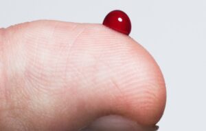 Scientists Identify How Young Blood Reverses Aging in Human Skin Cells