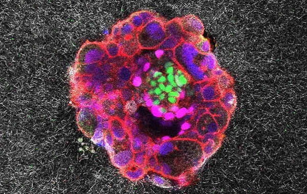 Bir Embriyonun Rahme Nasıl "Tutunduğu" İlk Kez Videoya Alındı