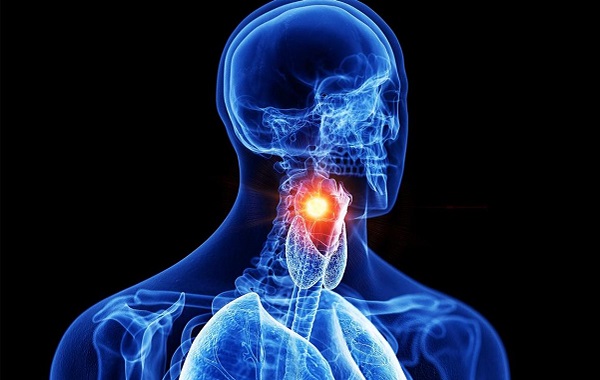 Yapay Zeka Sadece Sesinizi Dinleyerek Gırtlak Kanserini Teşhis Edebilir