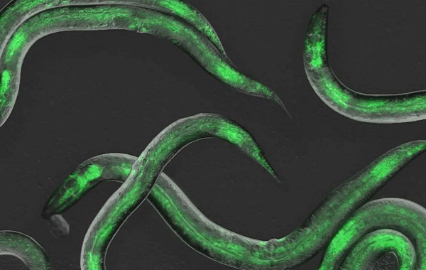 RNA'yı Düzenleyerek Yaşlanmayı Yavaşlatan Protein Tanımlandı