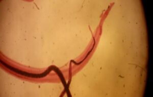 This Parasitic Worm Can Turn Off Your Ability to Feel Pain