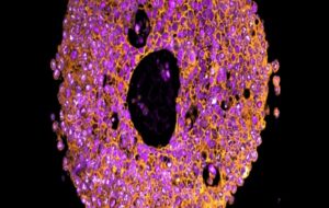 Mini Placentas 3D-Printed in a Lab in Amazing World First