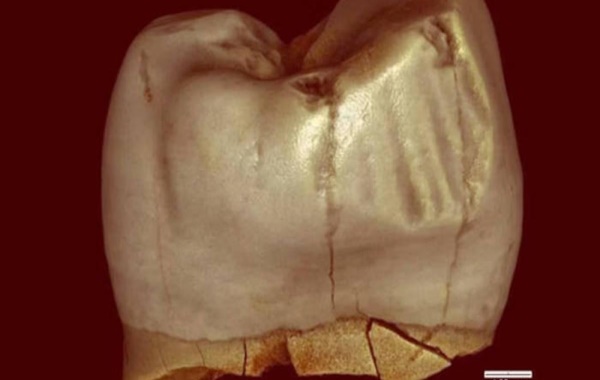 Antik Dişlerdeki İzler