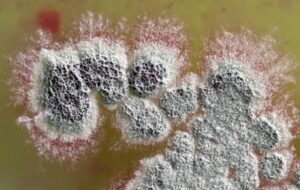 Toprakta Süper Mikropları Öldüren Yeni ve Güçlü Bir Antibiyotik Keşfedildi