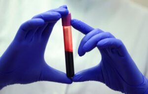 Beyond the Century Mark: The Hidden Chemical Secrets of the World’s Oldest Humans