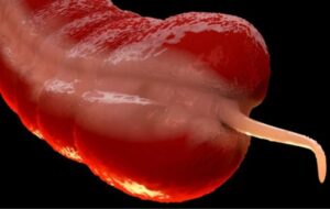 The Silent Epidemic: Why a Rare Cancer is Quadrupling in Millennials and Puzzling Scientists