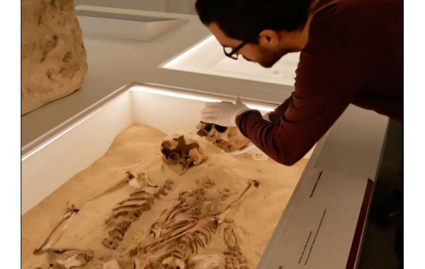 Ancient DNA reveals 12,000-year-old case of rare genetic disease