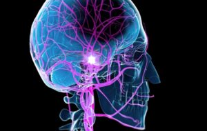 Study Reveals an Unexpected Way to Boost Recovery After a Stroke