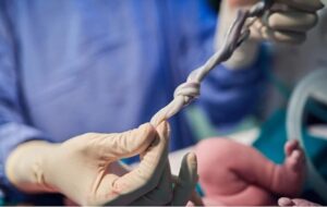 Bilim İnsanları Göbek Kordonu Kanında Endişe Verici Bir Şey Keşfetti