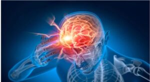 Kronik Ağrı Bir Hastalık