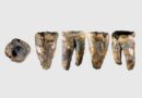 Antik Diş Hekimliği: Altay'da Tedavi İzleri Taşıyan Bir Neandertal Dişi Bulundu