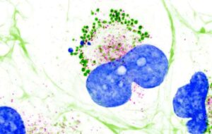 Scientists discover collagen, the human body's most abundant protein, is liquid-like inside cells